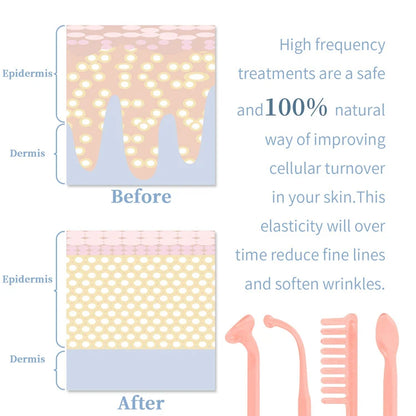 Portable Handheld High Frequency Skin Therapy Wand Machine for Acne Massage Skin Rejuvenation Tightening Wrinkle Reducing Tool